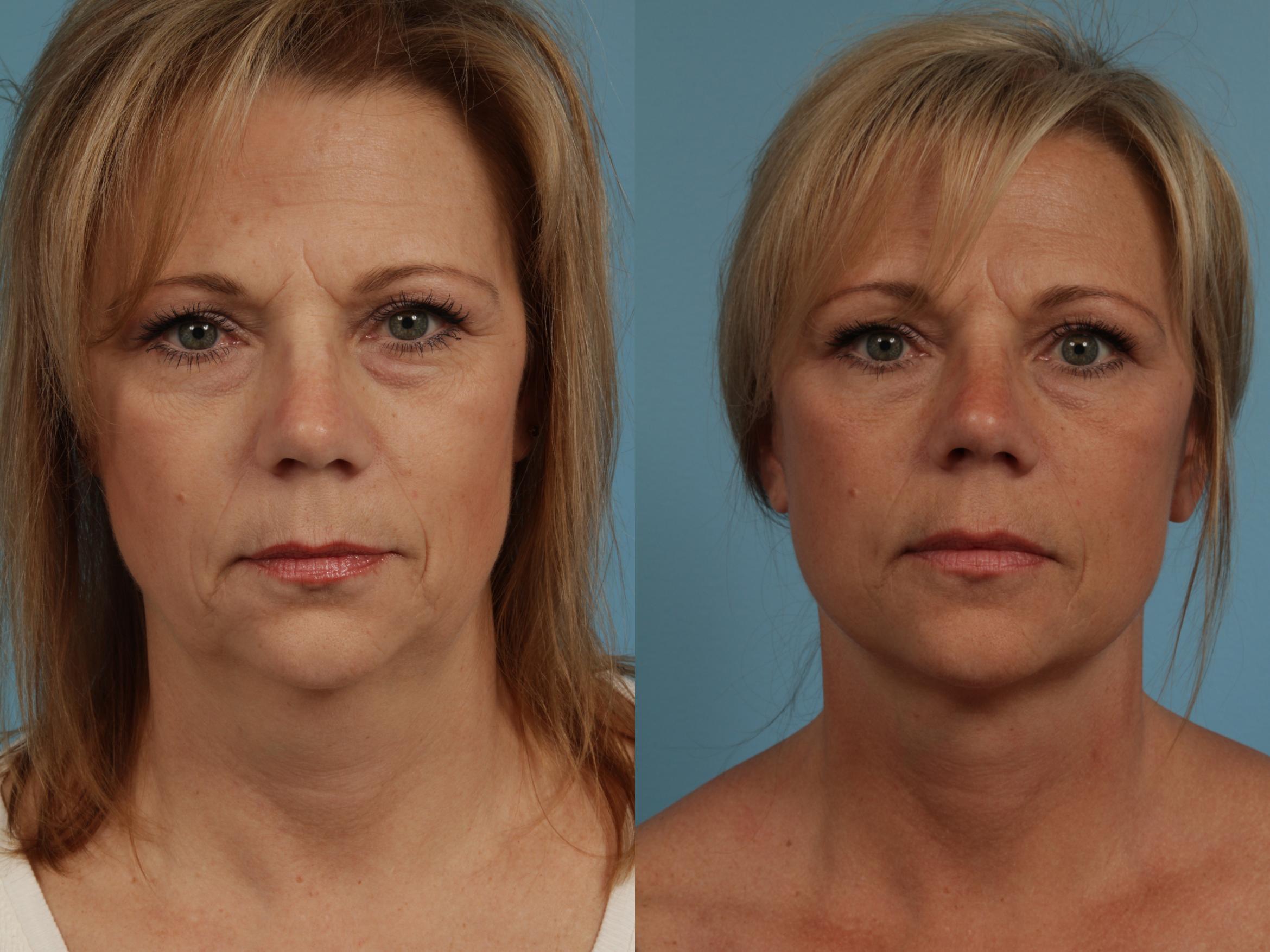 san diego dermatology and cosmetic surgery